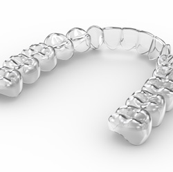 Illustration of a single Invisalign aligner